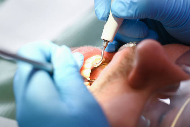 Best Emergency TMJ Treatment in Oakland City, IN